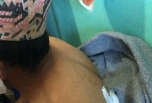 Photo of रसुवामा भालुको आक्रमणबाट दुई जना घाइते