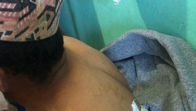 Photo of रसुवामा भालुको आक्रमणबाट दुई जना घाइते