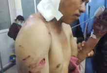 Photo of भालुको आक्रमणबाट युवक घाइते