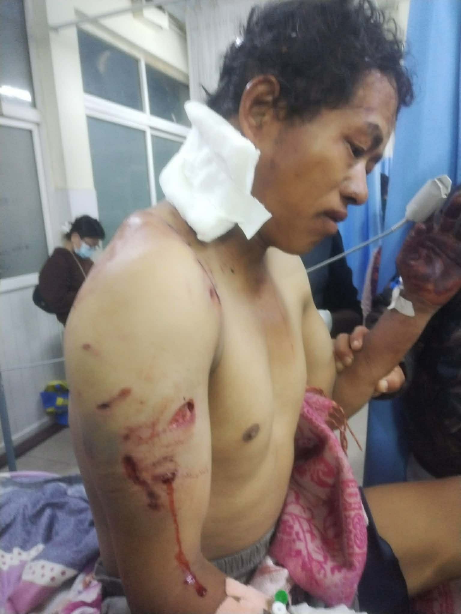 भालुको आक्रमणबाट युवक घाइते